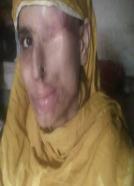 Saving Face