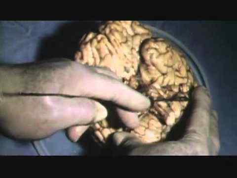 The Brain That Changes Itself - trailer 1