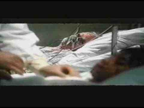 Variola vera - trailer